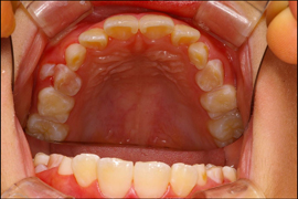 矯正歯科症例