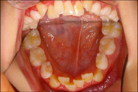矯正歯科症例
