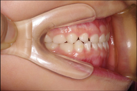 矯正歯科症例